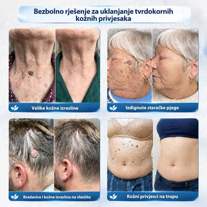 𝐏𝐢𝐜𝐝𝐨®🧑‍⚕️ 7-dnevna 𝐤𝐫𝐞𝐦𝐚 𝐳𝐚 𝐤𝐨ž𝐧𝐞 𝐢𝐳𝐫𝐚𝐬𝐭𝐚𝐣𝐞 & 𝐩𝐢𝐠𝐦𝐞𝐧𝐭𝐚𝐜𝐢𝐣𝐬𝐤𝐞 𝐦𝐫𝐥𝐣𝐞 (bezbolna formula – bez ožiljaka)🎁