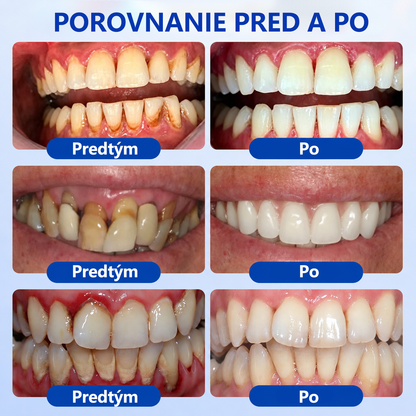 🇪🇺🏅🦷 Evolvion® GumRevive Gel za obnovu parodonta📦