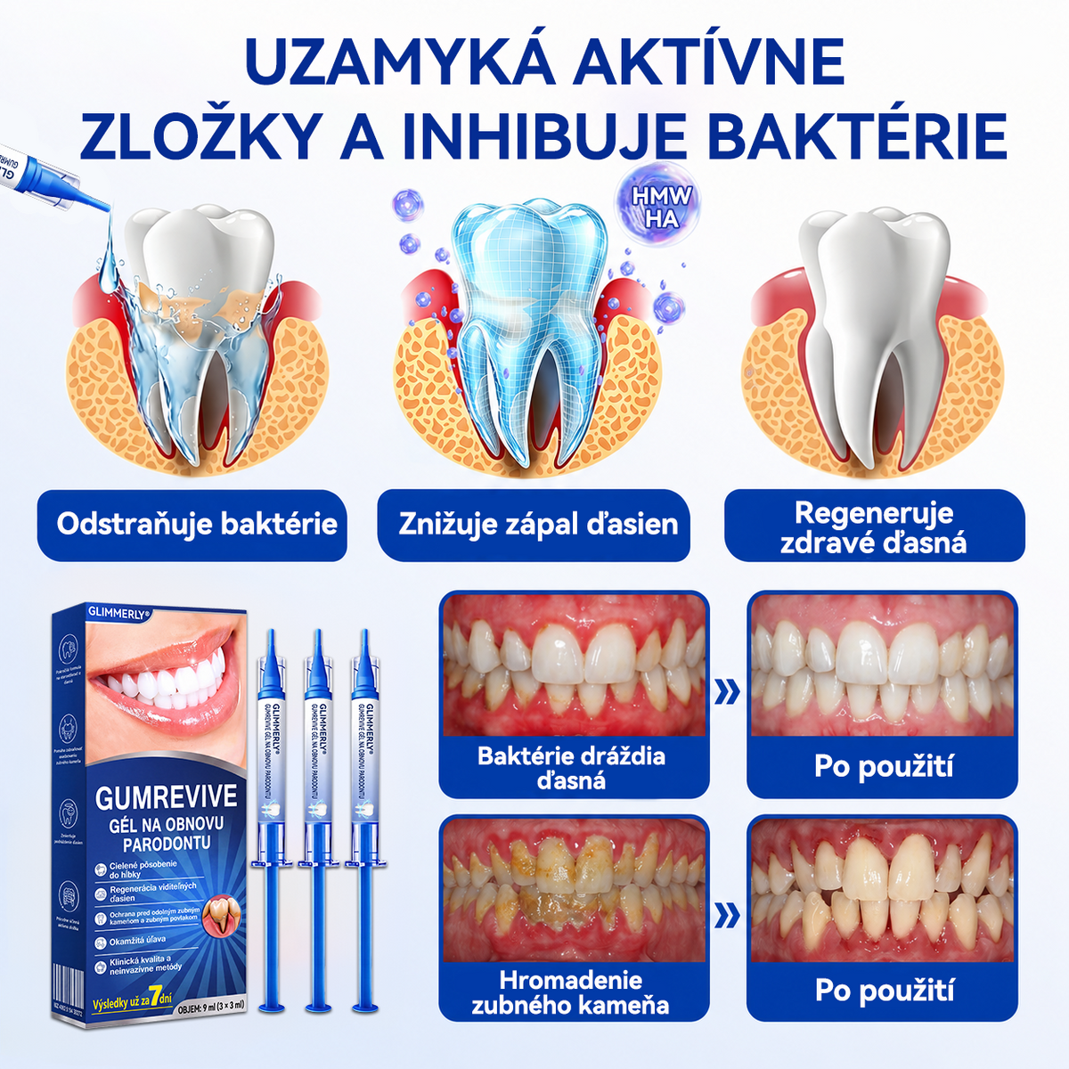 🇪🇺🏅🦷 Evolvion® GumRevive Gel za obnovu parodonta📦