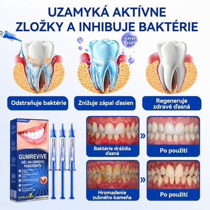🇪🇺🏅🦷 Evolvion® GumRevive Gel za obnovu parodonta📦