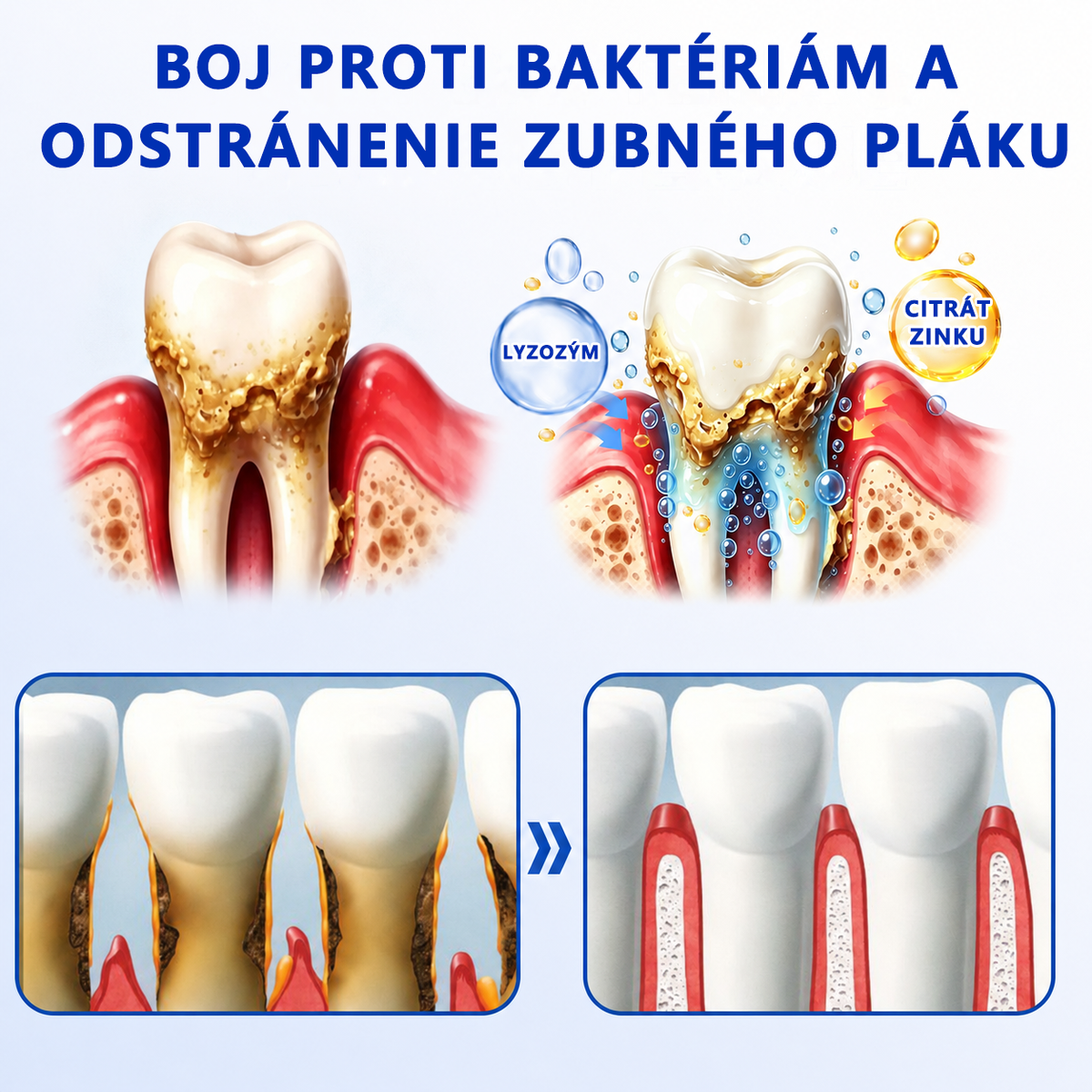 🇪🇺🏅🦷 Evolvion® GumRevive Gel za obnovu parodonta📦