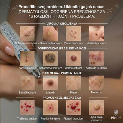 𝑱𝒆𝒅𝒊𝒏𝒂 𝒔𝒍𝒖ž𝒃𝒆𝒏𝒂 𝒕𝒓𝒈𝒐𝒗𝒊𝒏𝒂 | ✅️👩‍⚕️𝐏i𝐜𝐝o® 7 Dana Uklanjač mrlja i kožnih izraslina (Bezbolni roll-on aplikator bez ožiljaka) 🍐